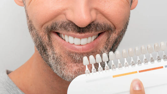 Bărbat zâmbitor ținând un ghid de nuanțe ale dinților după albire.